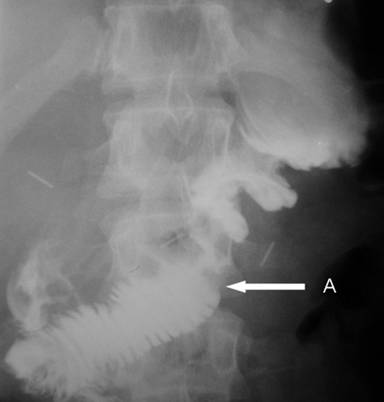 04_fig05.jpg