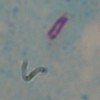 Ziehl-Neelsen stain showing acid fast bacilli
