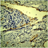 Immunohistochemical staining for CD31
